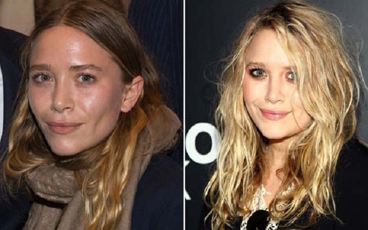 Mary Kate Olsen Plastic Surgery - The Real Truth Here